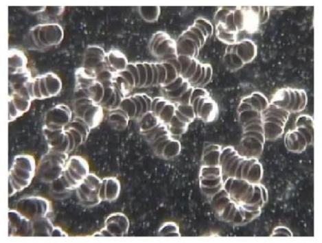 Microscope image of clustered blood cells