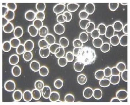 Microscope image of more separated blood cells